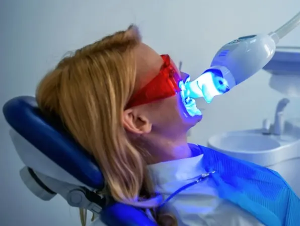 Czy wybielanie zębów można wykonywać przy koronach, licówkach lub wypełnieniach?